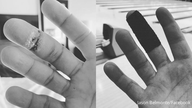 bpc 157 jammed finger 27-year-old presents a right - Page 2 of 2 Injured Belmonte To Use Pinky