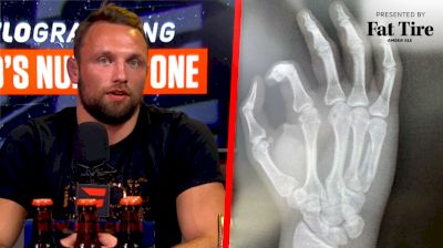 Craig Jones Tells The Saga Of His Broken Hand